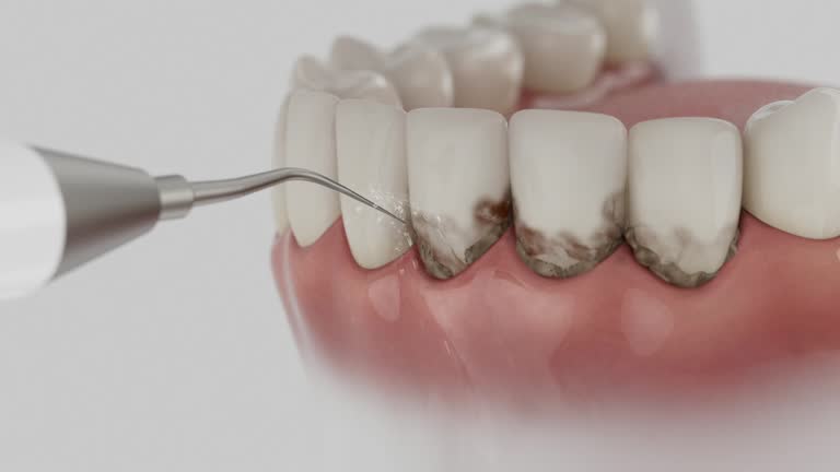 Reliable Teeth Cleaning And Checkup contractor in Crawford County County, MI by Dentist Open Now